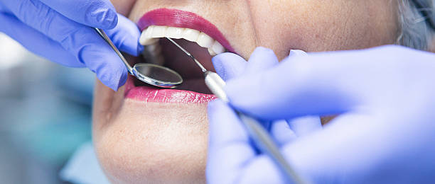 Best Broken or Chipped Tooth Repair in Perryville, MO